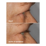 3ML Clinique HIGH IMPACT LASH AMPLIFIER Sérum amplificateur de cils  2 of 4 Sérum amplificateur de cils
