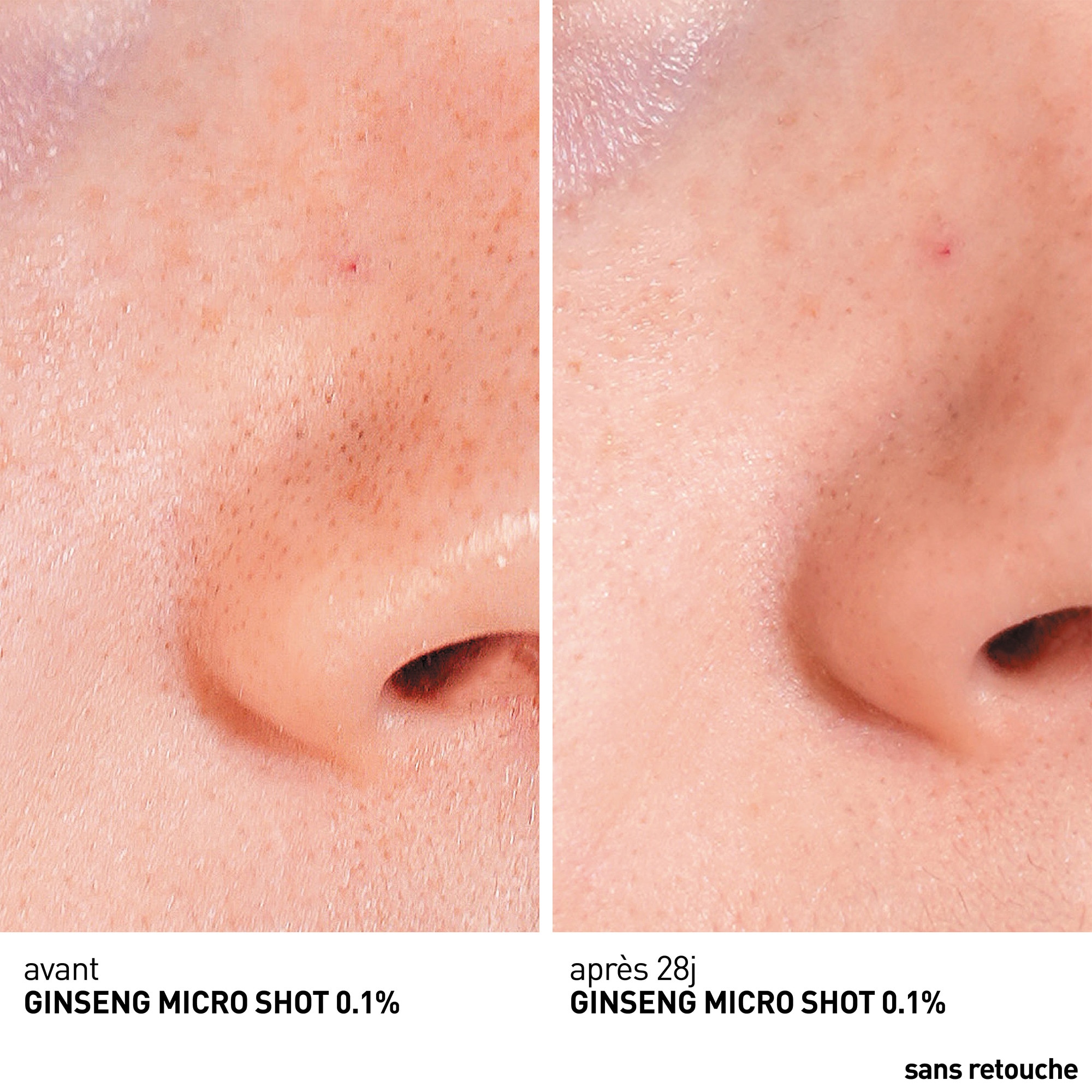 30ML ERBORIAN GINSENG MICRO SHOT STARTER 0.1 Sérum micro-infusion retexturant (concentration en spicules 0.1%) 1 of 4