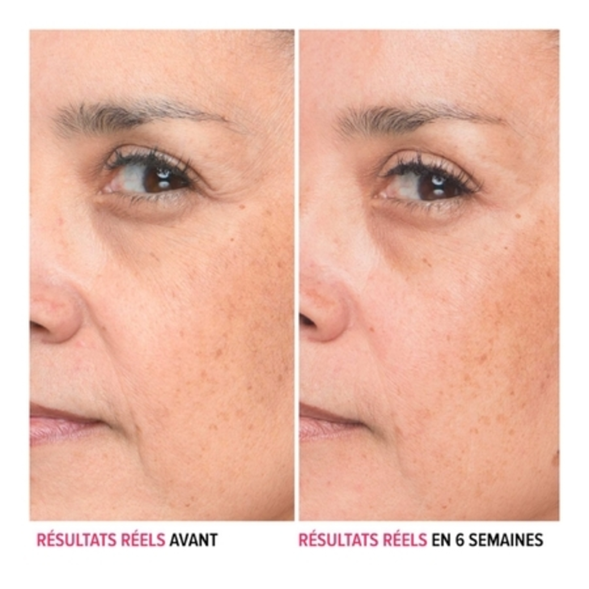 Sérum anti-ride à l'acide hyaluronique