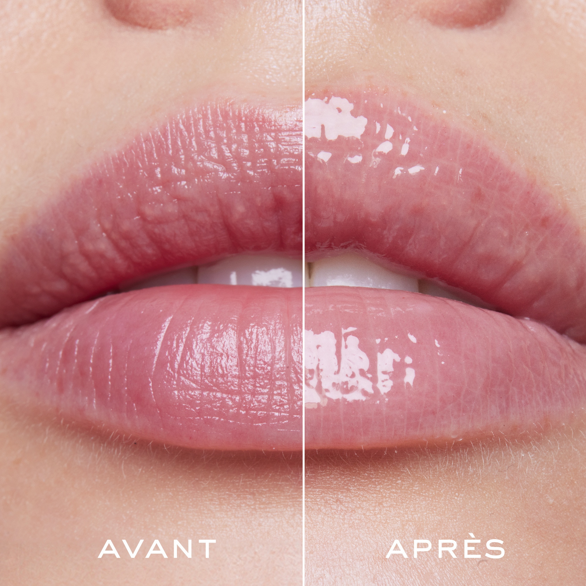 8ML Nuxe VERY ROSE Sérum lèvres repulpant avec étui & charms  1 of 4 