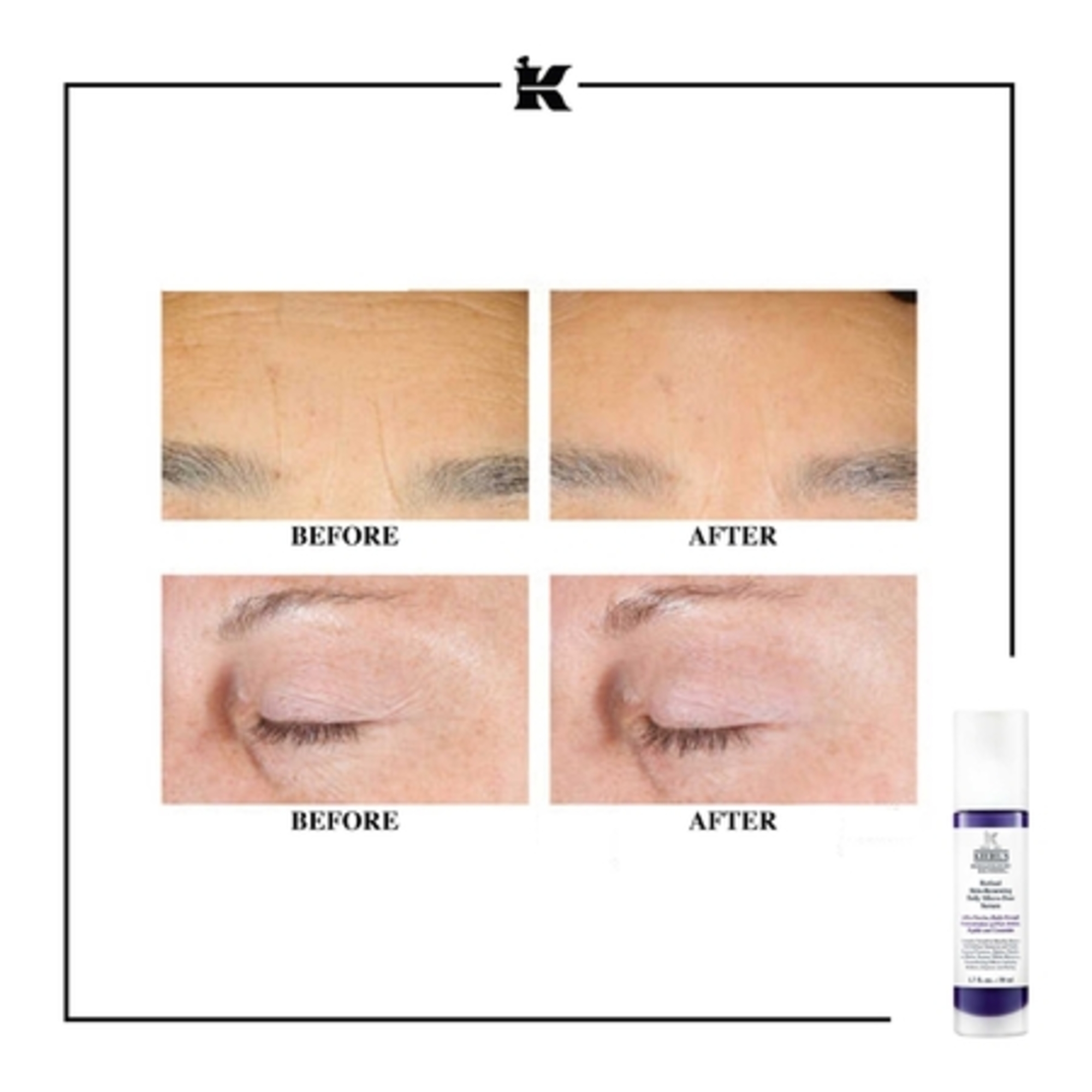 Sérum anti-âge au rétinol pur