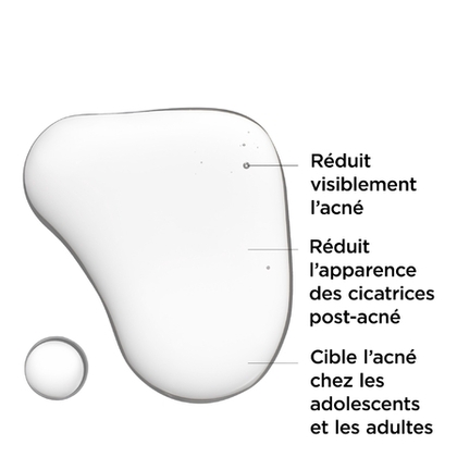 Sérum anti-acné à l'acide salicylique