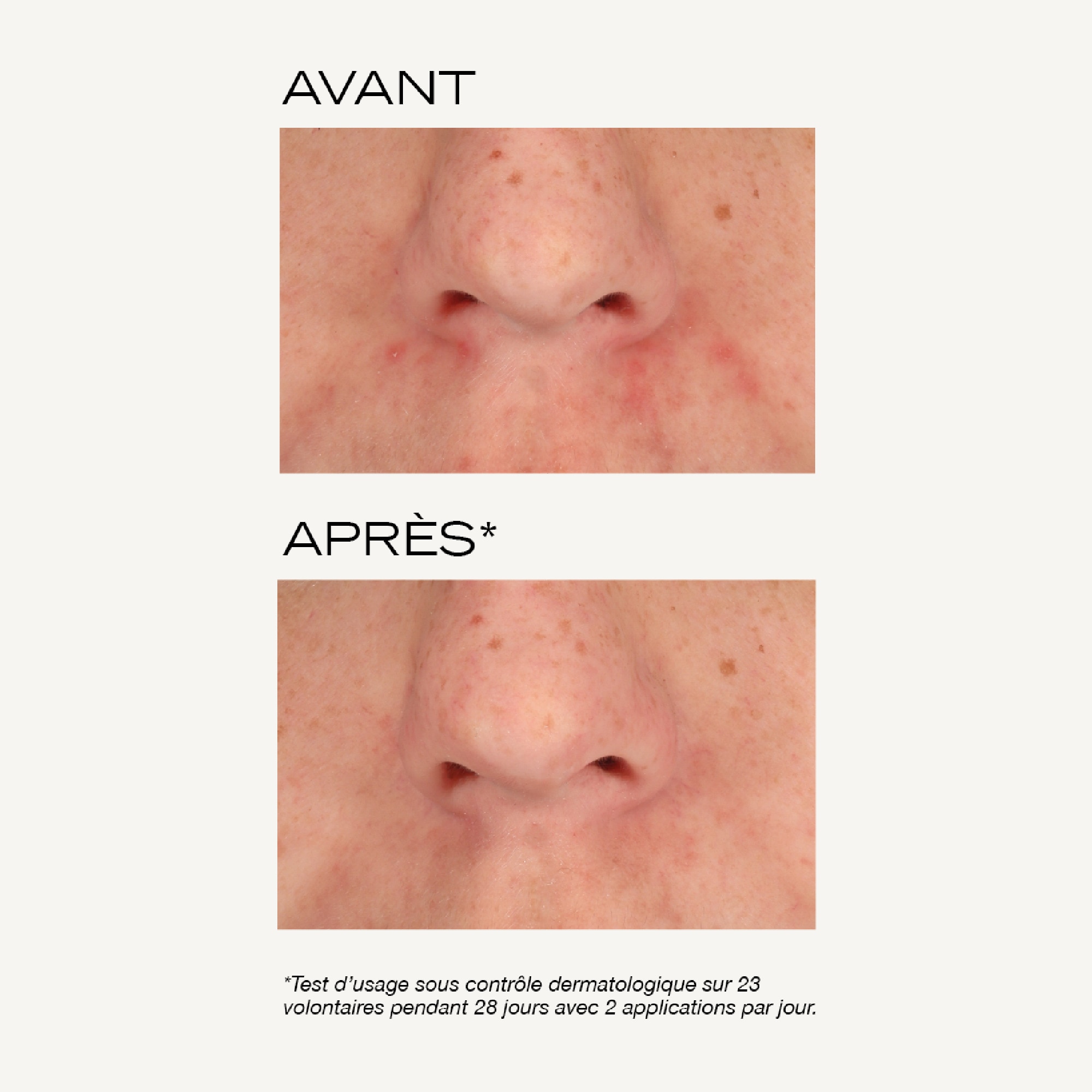 Masque peeling intense