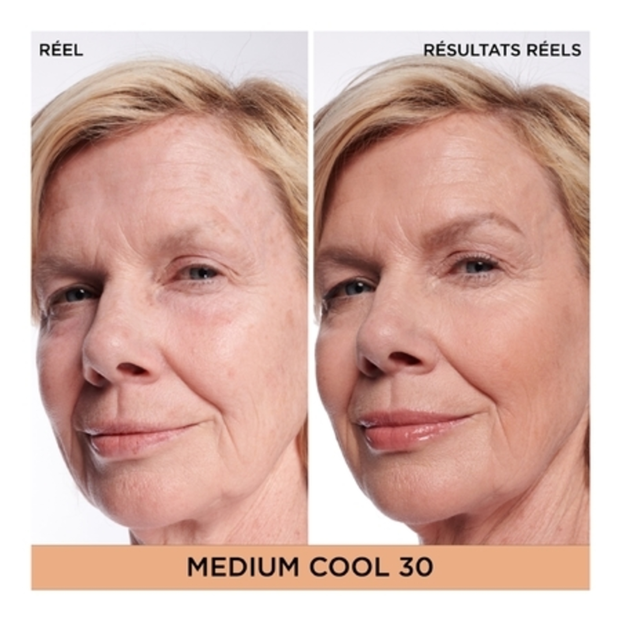 Correcteur global + sérum Bye Bye Dark Spots