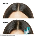 500ML L'ORÉAL PROFESSIONNEL SERIE EXPERT SCALP ADVANCED Shampooing niacinamide dermo-régulateur apaisant pour cuirs chevelus sensibles sujets aux démangeaisons. 4 of 4 Shampooing niacinamide dermo-régulateur apaisant pour cuirs chevelus sensibles sujets aux démangeaisons.