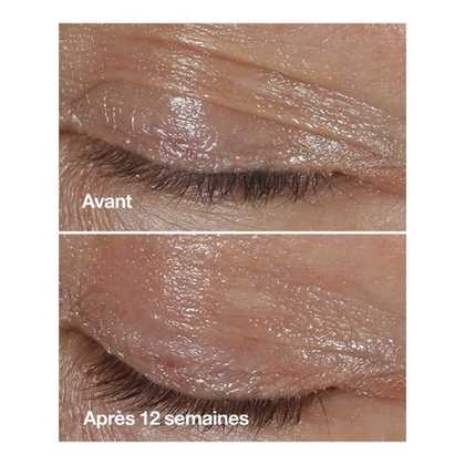 Crème Yeux Correction Rides