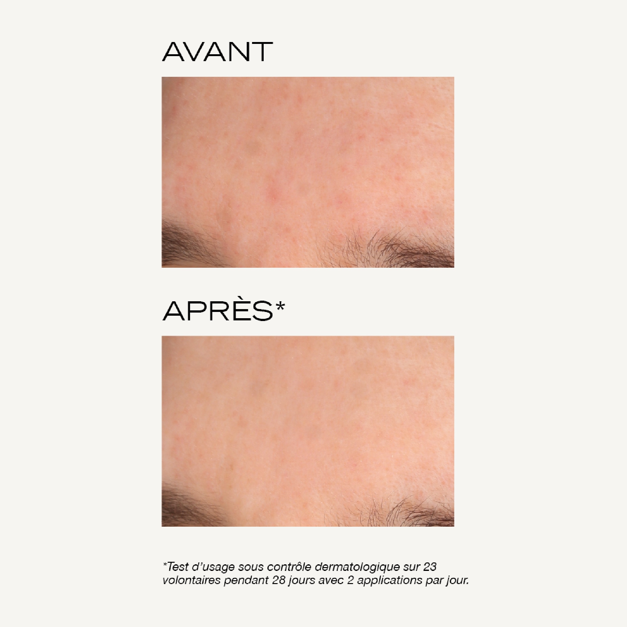 Masque peeling intense