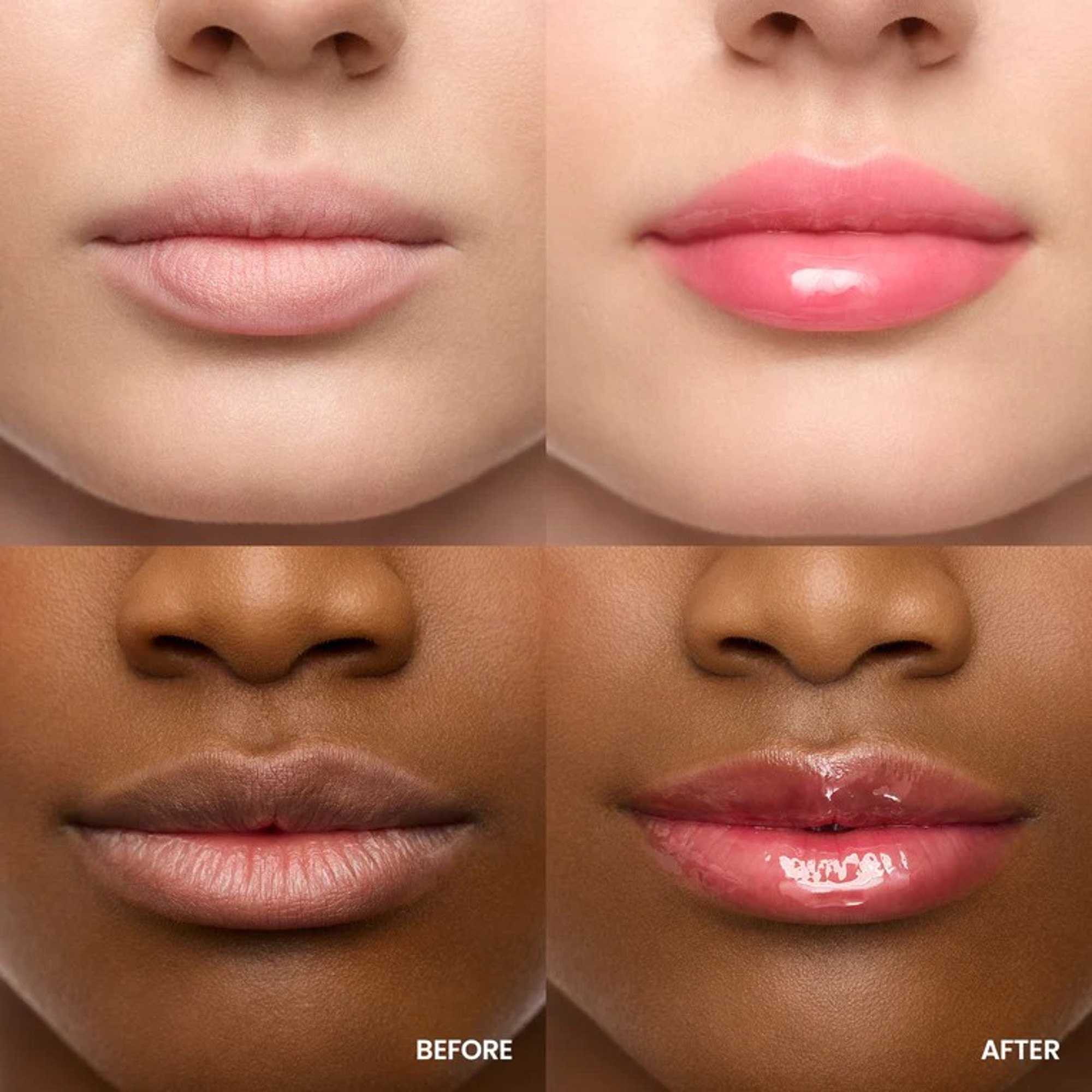  WONDERSKIN LIP REHAB SERUM Huile à lèvres  1 of 4 
