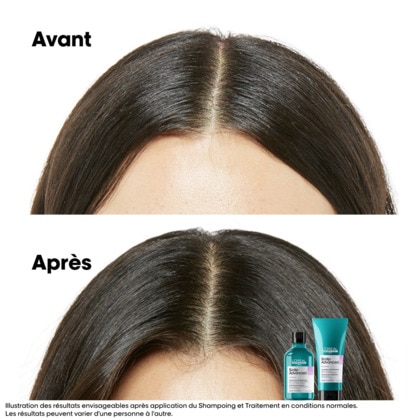 Shampooing niacinamide dermo-régulateur apaisant pour cuirs chevelus sensibles sujets aux démangeaisons.