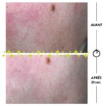 100mL GARANCIA PSCHITT MAGIQUE NOUVELLE PEAU Micropeeling visage 3 of 5 Micropeeling visage
