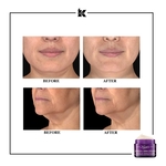50ml KIEHLS SUPER MULTI-CORRECTIVE Crème super multi-correctrice global anti-âge  3 of 4 Crème super multi-correctrice global anti-âge