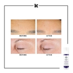 30ML KIEHLS RETINOL SKIN-RENEWING DAILY MICRO-DOSE SERUM Sérum anti-âge au rétinol pur  3 of 4 Sérum anti-âge au rétinol pur