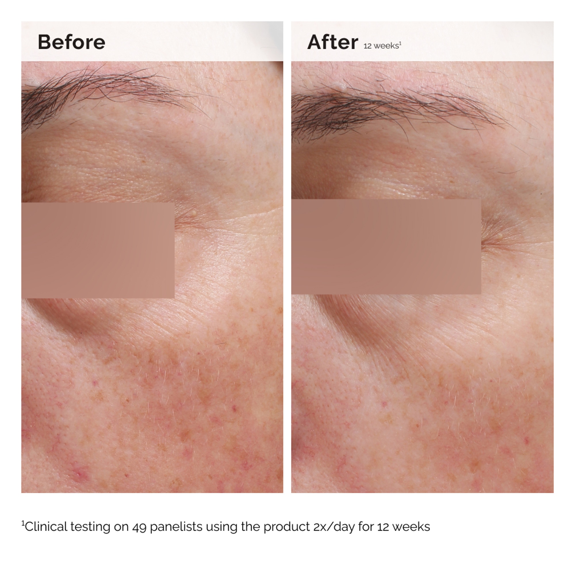 Émulsion visage et corps à la niacinamide 5%