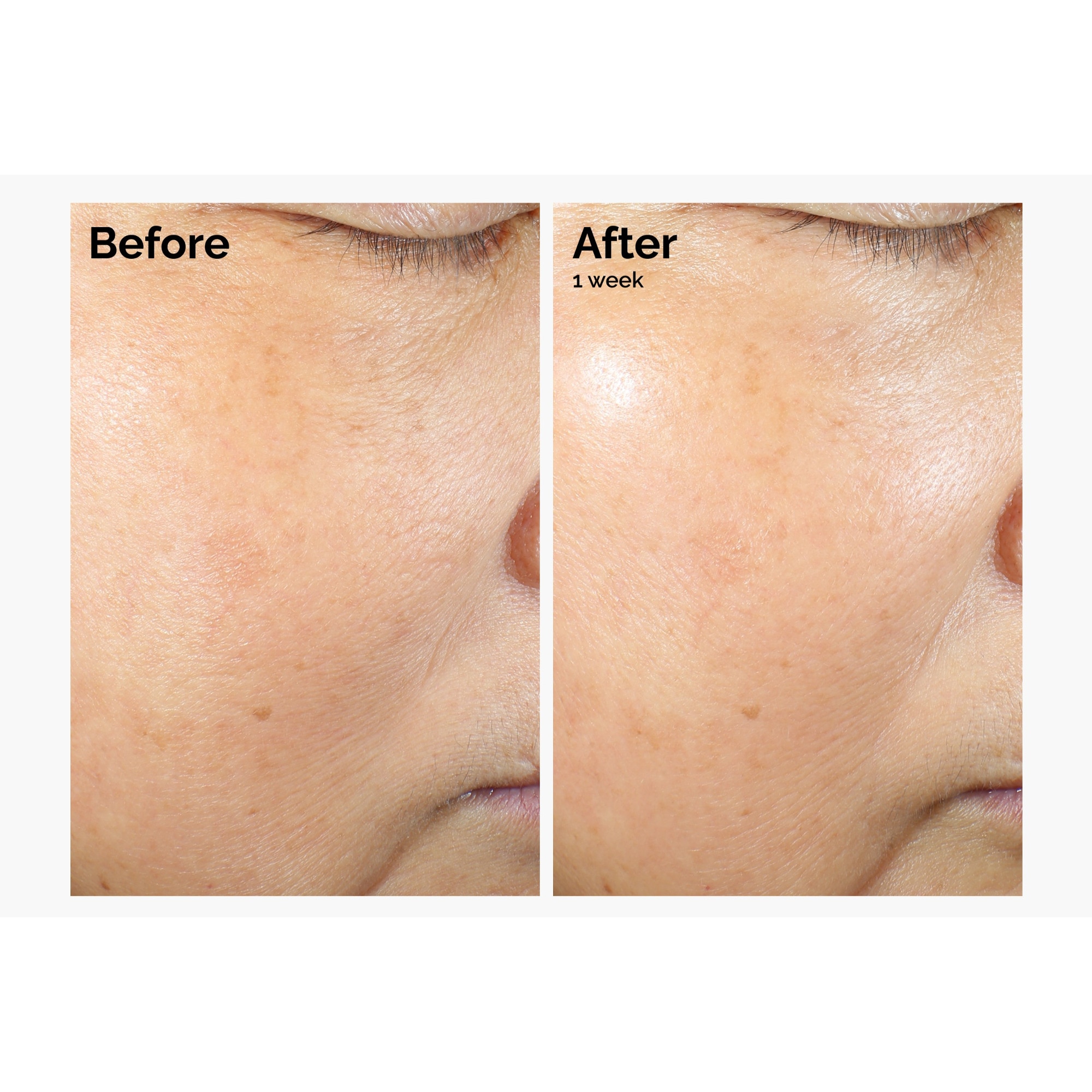 Microémulsion de lipides de riz + ectoïne