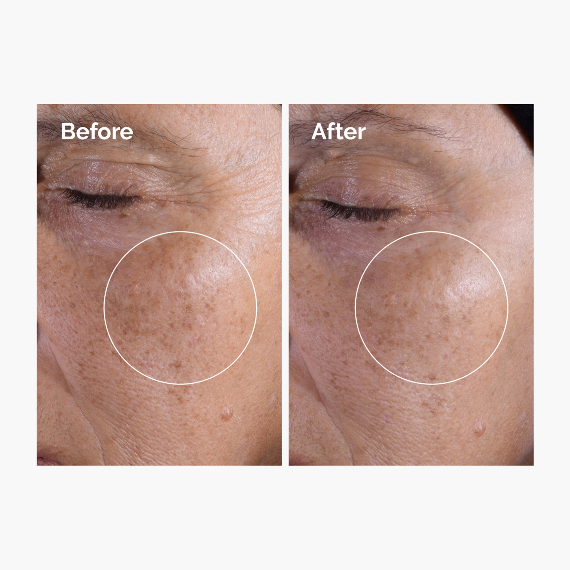 Tonique exfoliant à l'acide glycolique 7%