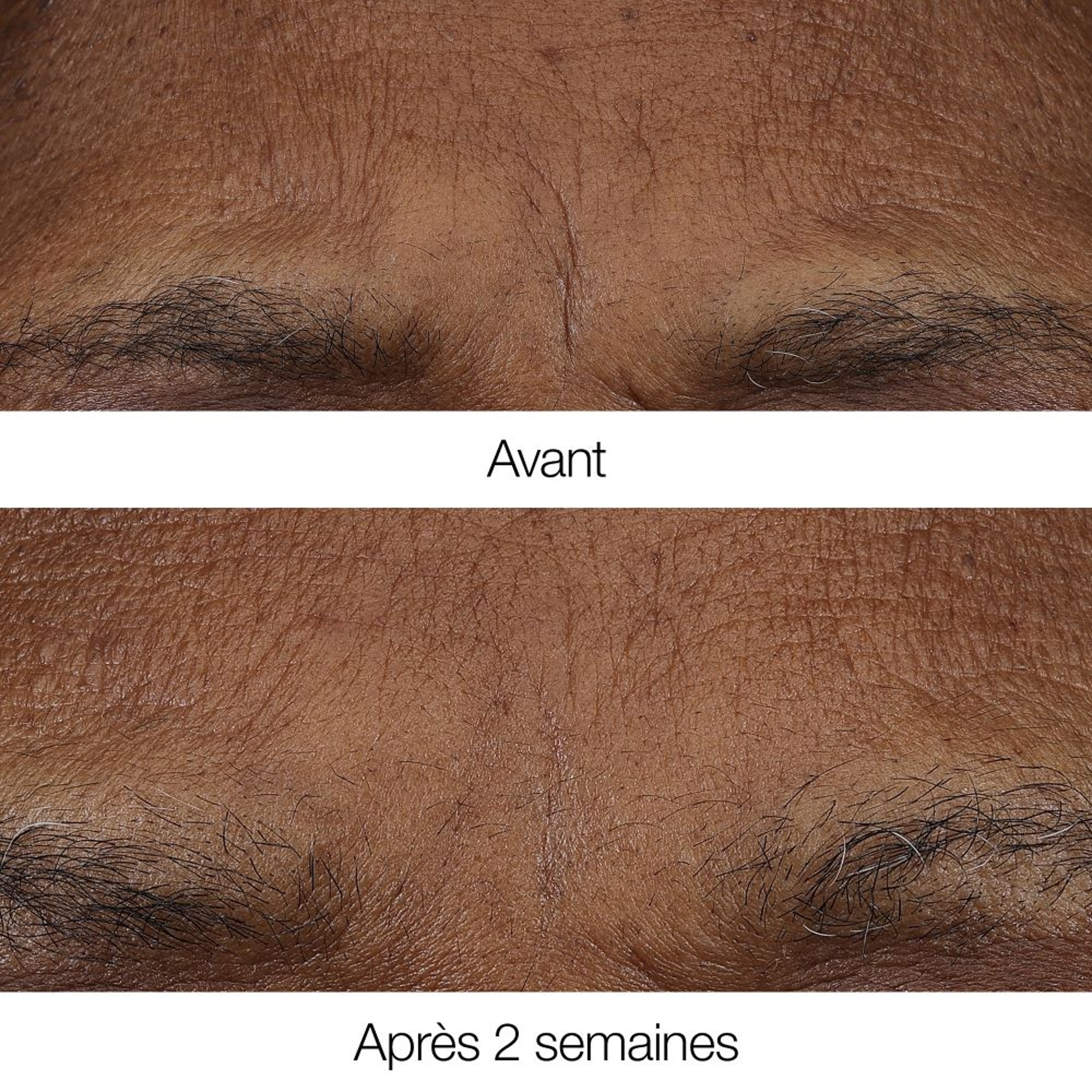 Baume rétinoïde matin/soir