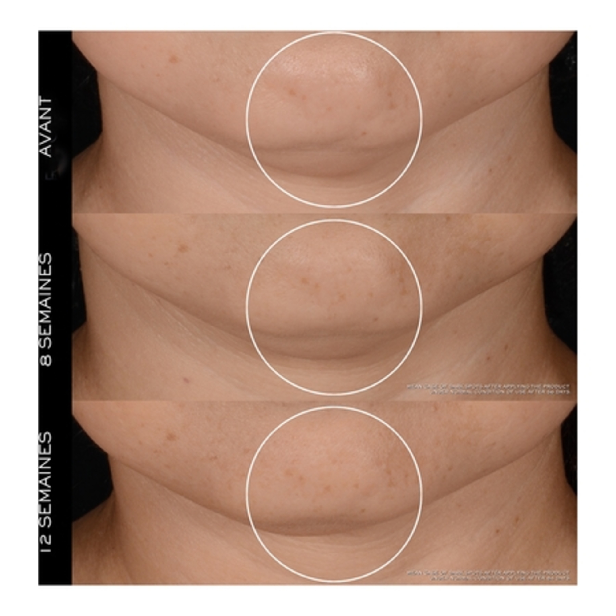 Crème anti-âge haute-performance - rechargeable