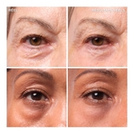 15ML IT COSMETICS BYE BYE UNDER EYE BAGS Traitement pour les poches  2 of 4 Traitement pour les poches
