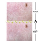 100ML GARANCIA PSCHITT MAGIQUE Micropeeling sans grain à action biologique  2 of 3 Micropeeling sans grain à action biologique