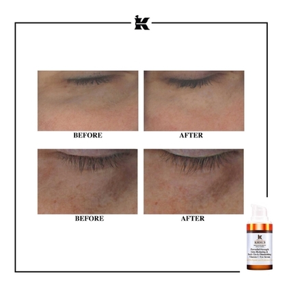 15ML KIEHLS POWERFUL-STRENGTH LINE-REDUCING Sérum contour des yeux réducteur de rides & anti-cernes à la vitamine C  1 of 4 