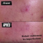 125ML KIEHLS DERMATOLOGIST SOLUTIONS Pâte anti-imperfections 3-en-1 3 of 4 Pâte anti-imperfections 3-en-1