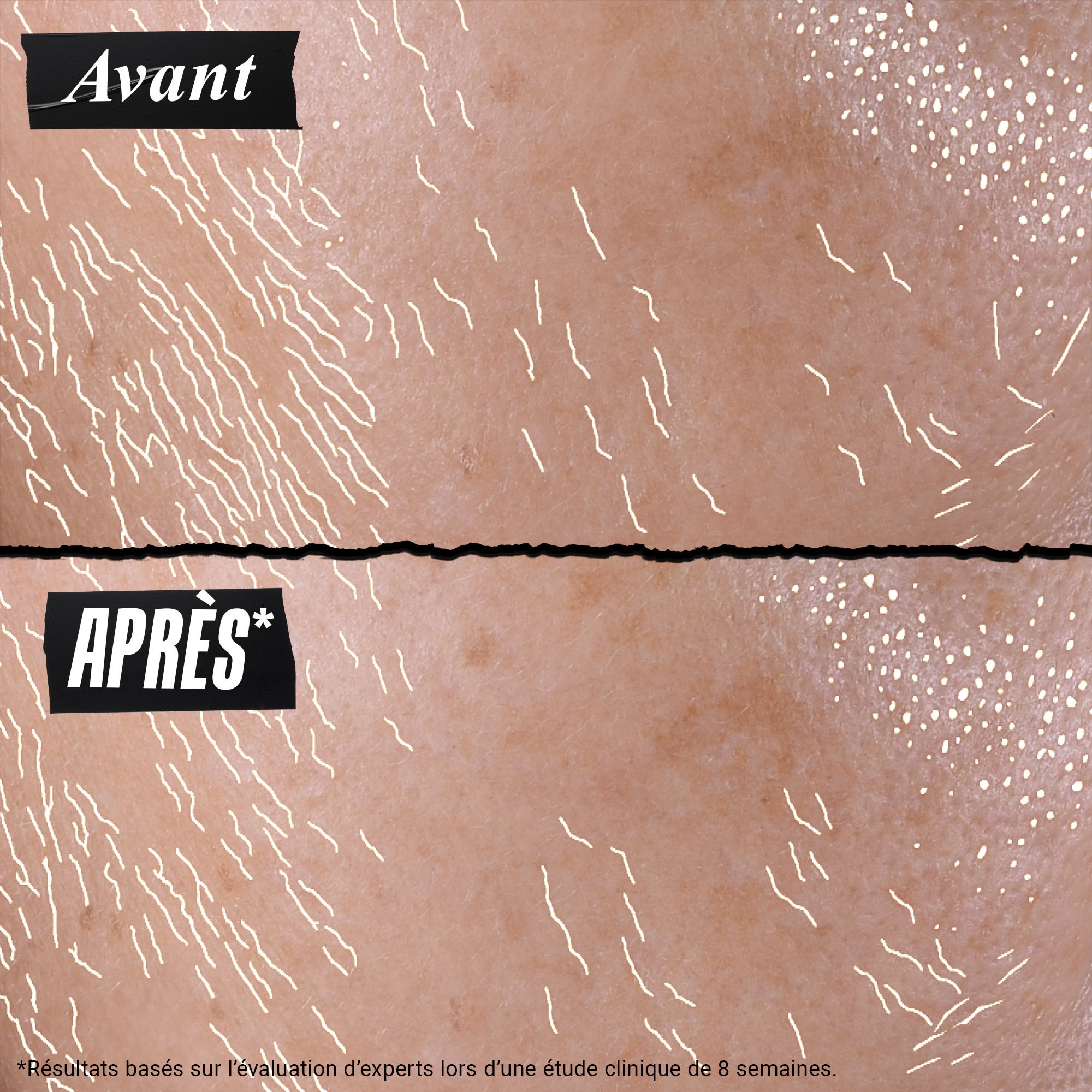 Sérum uv collagène