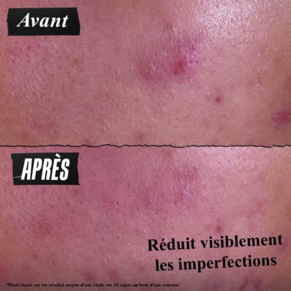Pâte anti-imperfections 3-en-1