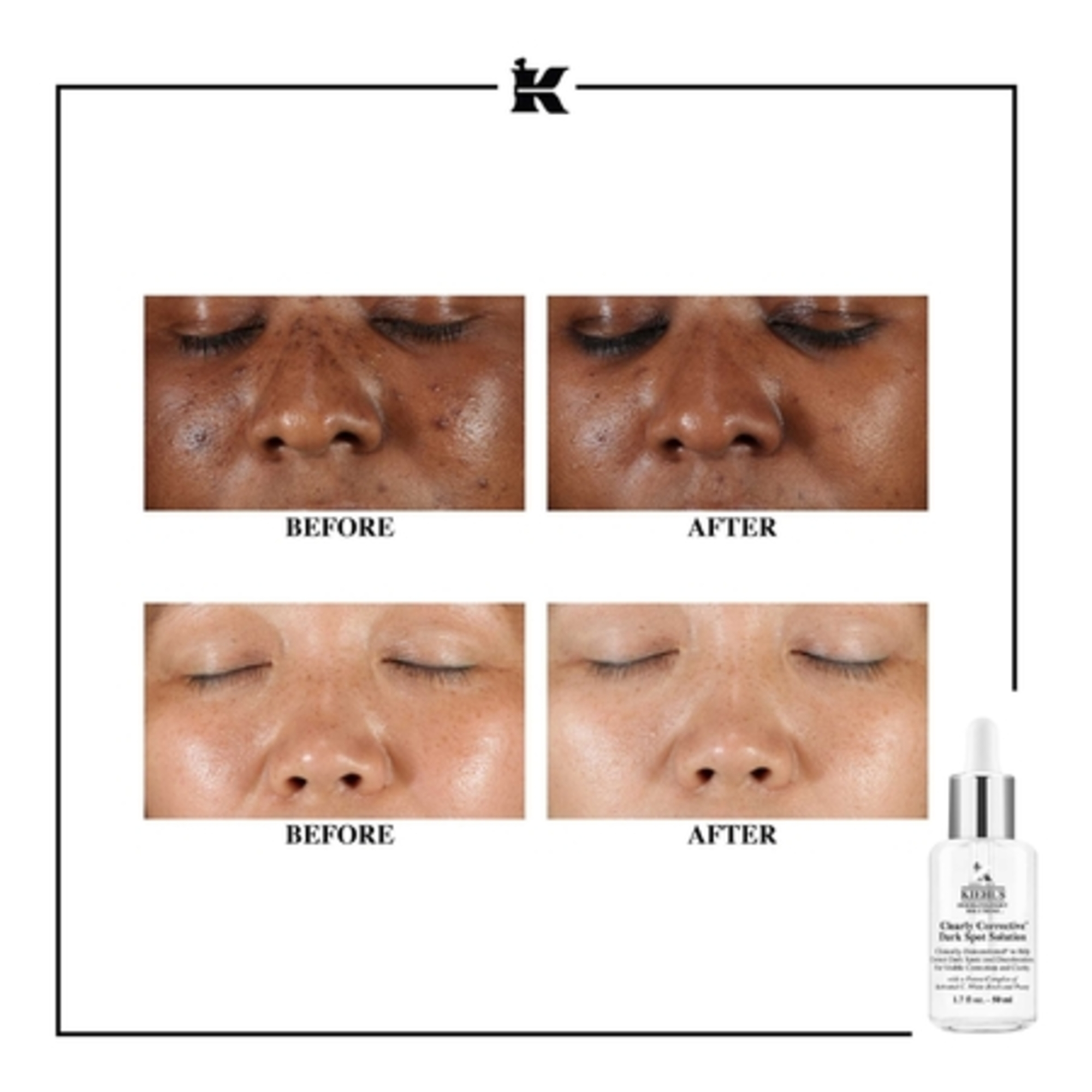 Sérum éclat réducteur de taches