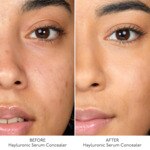 BY TERRY HYALURONIC SERUM CONCEALER Anti-cernes 3 of 4 Anti-cernes
