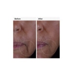 30ML THE ORDINARY SIGNES DE L'AGE Solution gf 15%  3 of 4 Solution gf 15%
