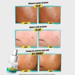15ML KIEHLS DERMATOLOGIST SOLUTIONS Solution ciblée anti-imperfections  3 of 4 Solution ciblée anti-imperfections