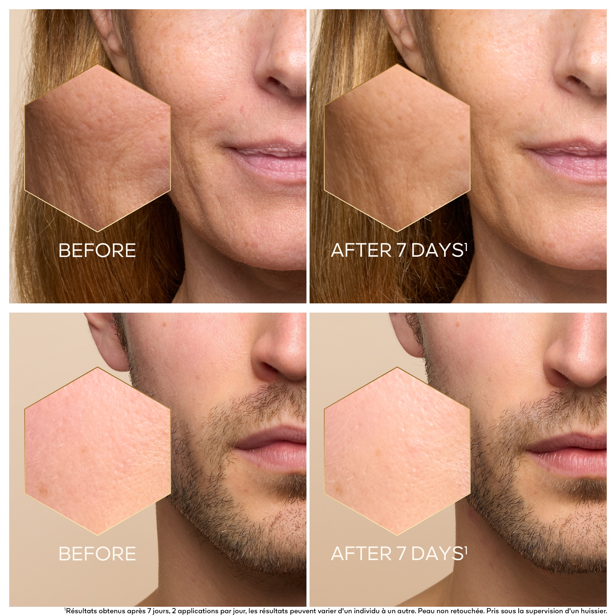 Serum huile-en-eau jeunesse