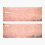 30ML THE ORDINARY SÉCHERESSE ET DÉSHYDRATATION Acide hyaluronique 2% + b5 4 of 4 Acide hyaluronique 2% + b5