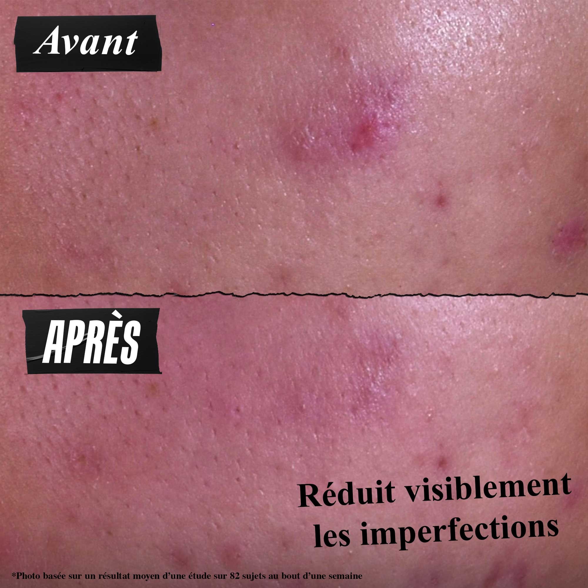 Pâte anti-imperfections 3-en-1