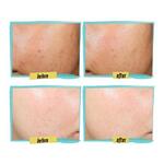 60ml KIEHLS DERMATOLOGIST SOLUTIONS Lotion anti-imperfections  3 of 4 Lotion anti-imperfections
