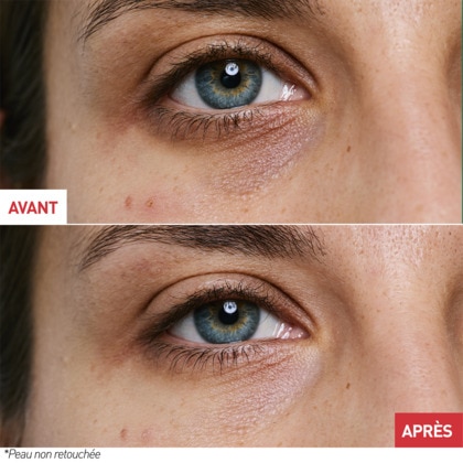 Crème yeux multi-perfectrice