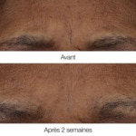 3G Clinique SMART CLINICAL REPAIR™ Baume rétinoïde matin/soir 3 of 4 Baume rétinoïde matin/soir
