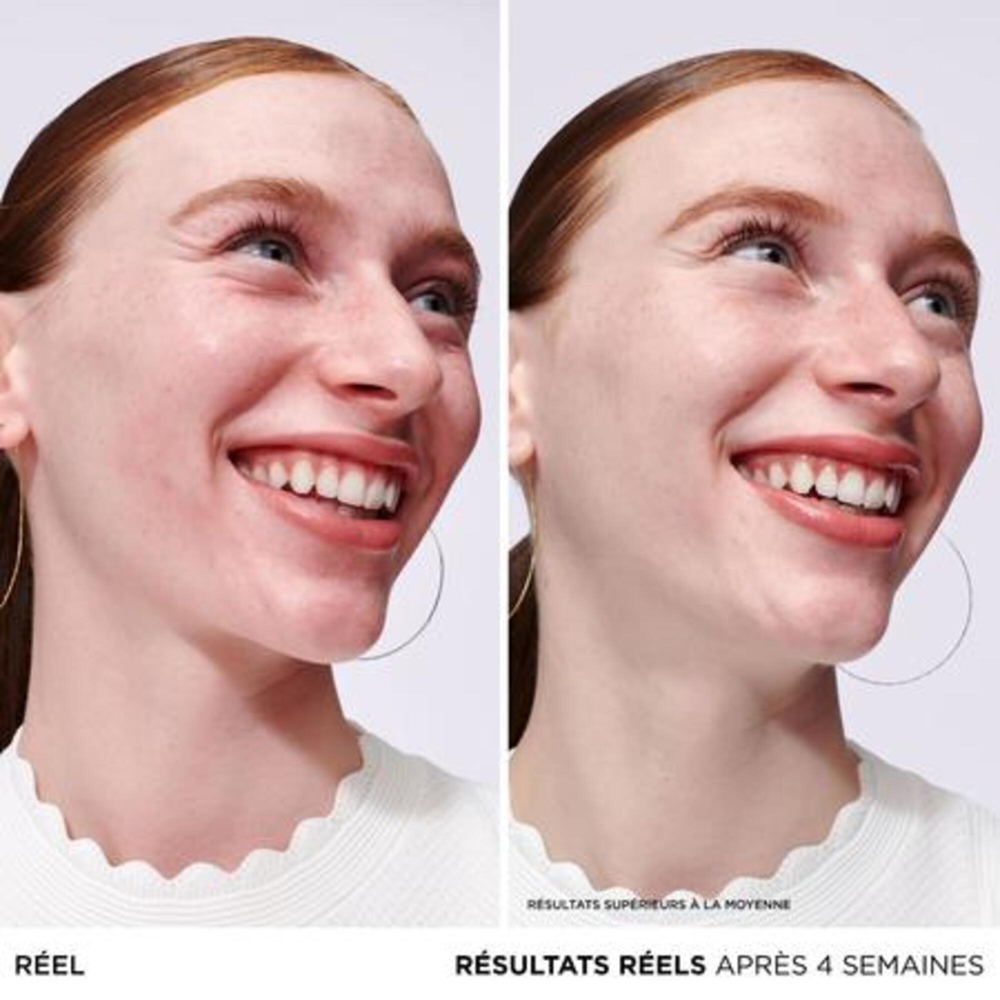 Sérum anti-rougeurs à l'avoine colloïdale