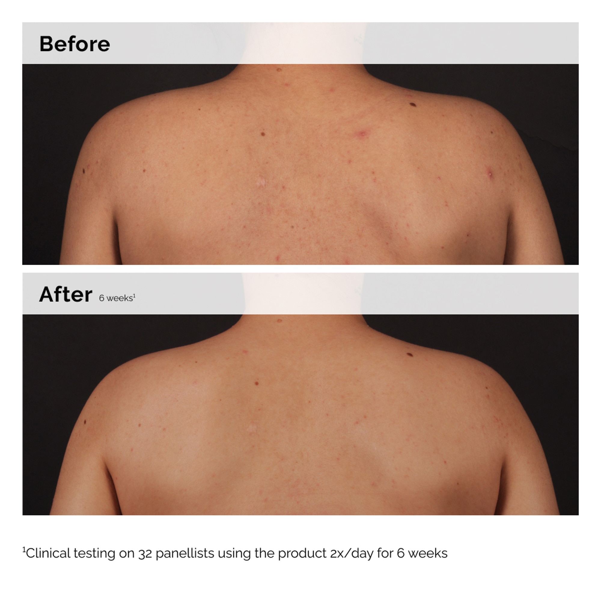 Sérum corps à l'acide salicylique 0.5%