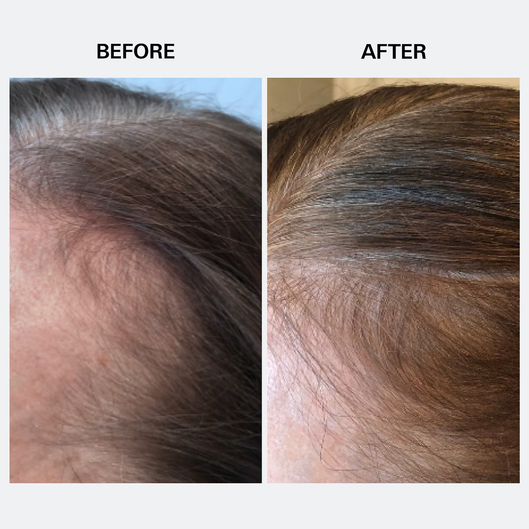 Soin collagène pour le cuir chevelu