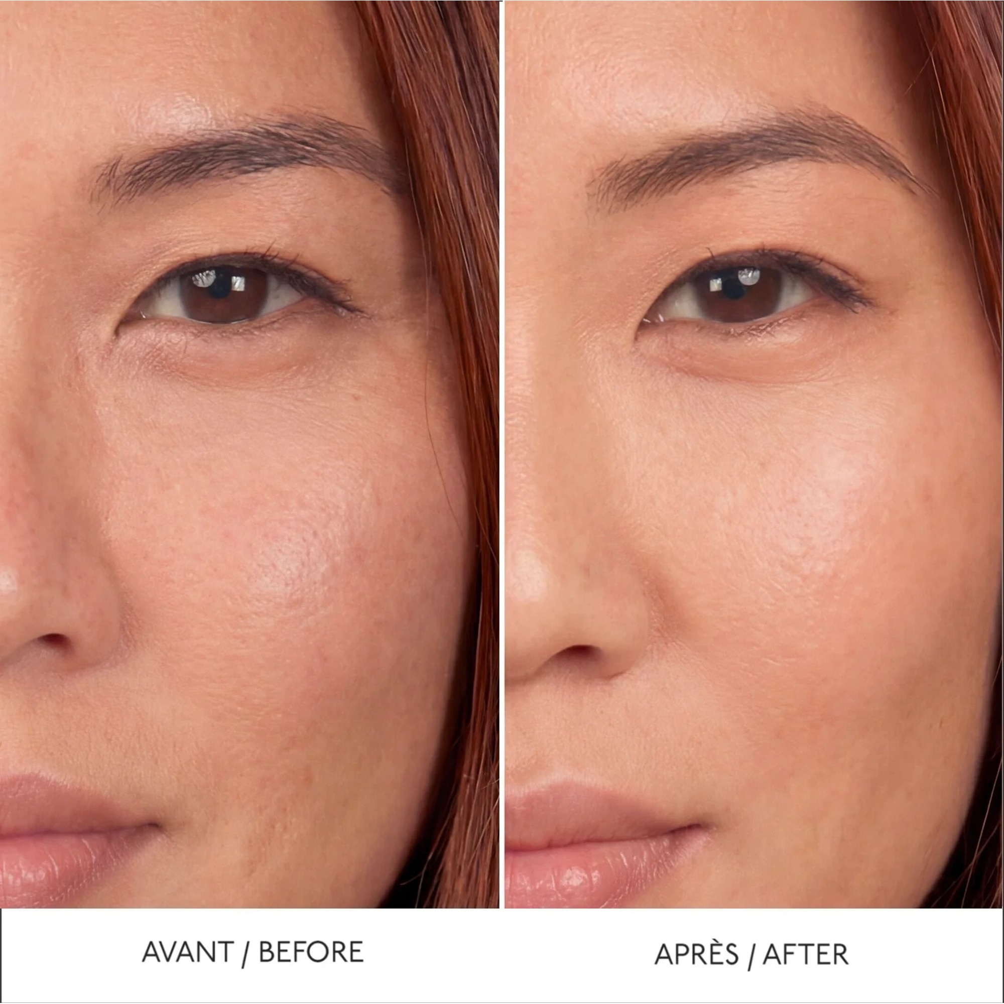  BY TERRY HYALURONIC SERUM CONCEALER Anti-cernes  1 of 3 