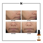 50ML KIEHLS POWERFUL-STRENGTH LINE-REDUCING Sérum puissant réducteur de rides à la vitamine C  3 of 4 Sérum puissant réducteur de rides à la vitamine C