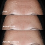 50mL Clinique SERUM SMART CLINICAL REPAIR Sérum correcteur anti-rides 3 of 4 Sérum correcteur anti-rides