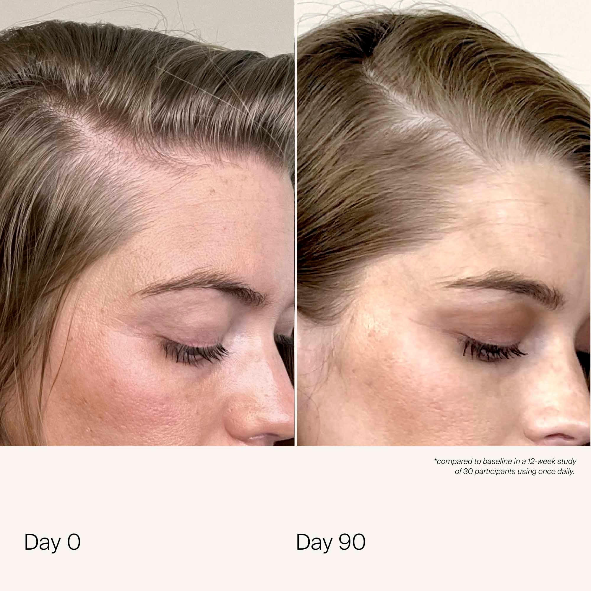 Scalp care density serum ? traitement cuir chevelu