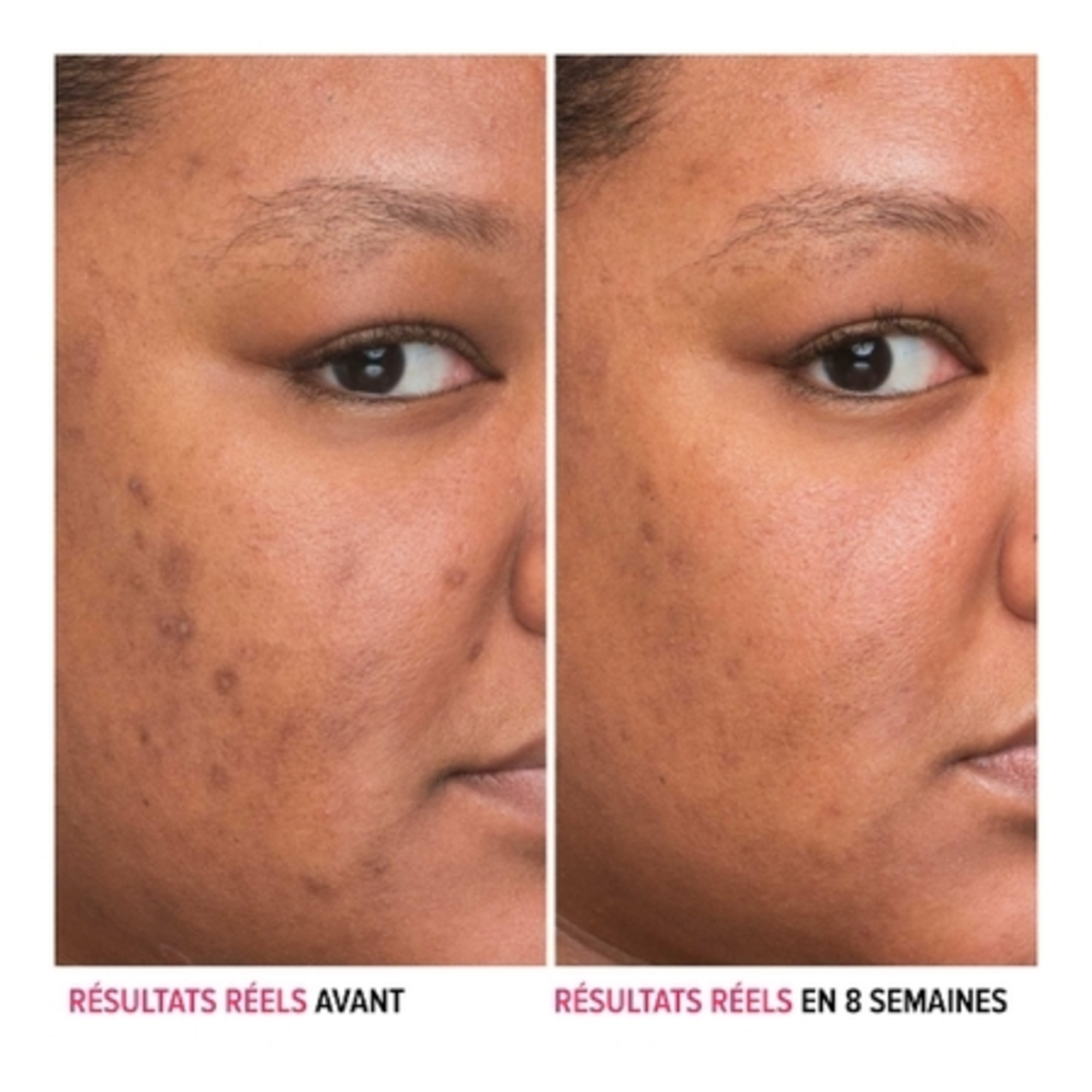 Sérum anti-taches à la niacinamide