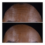 50mL Clinique SMART CLINICAL REPAIR™ Crème liftante visage & cou  3 of 4 Crème liftante visage & cou