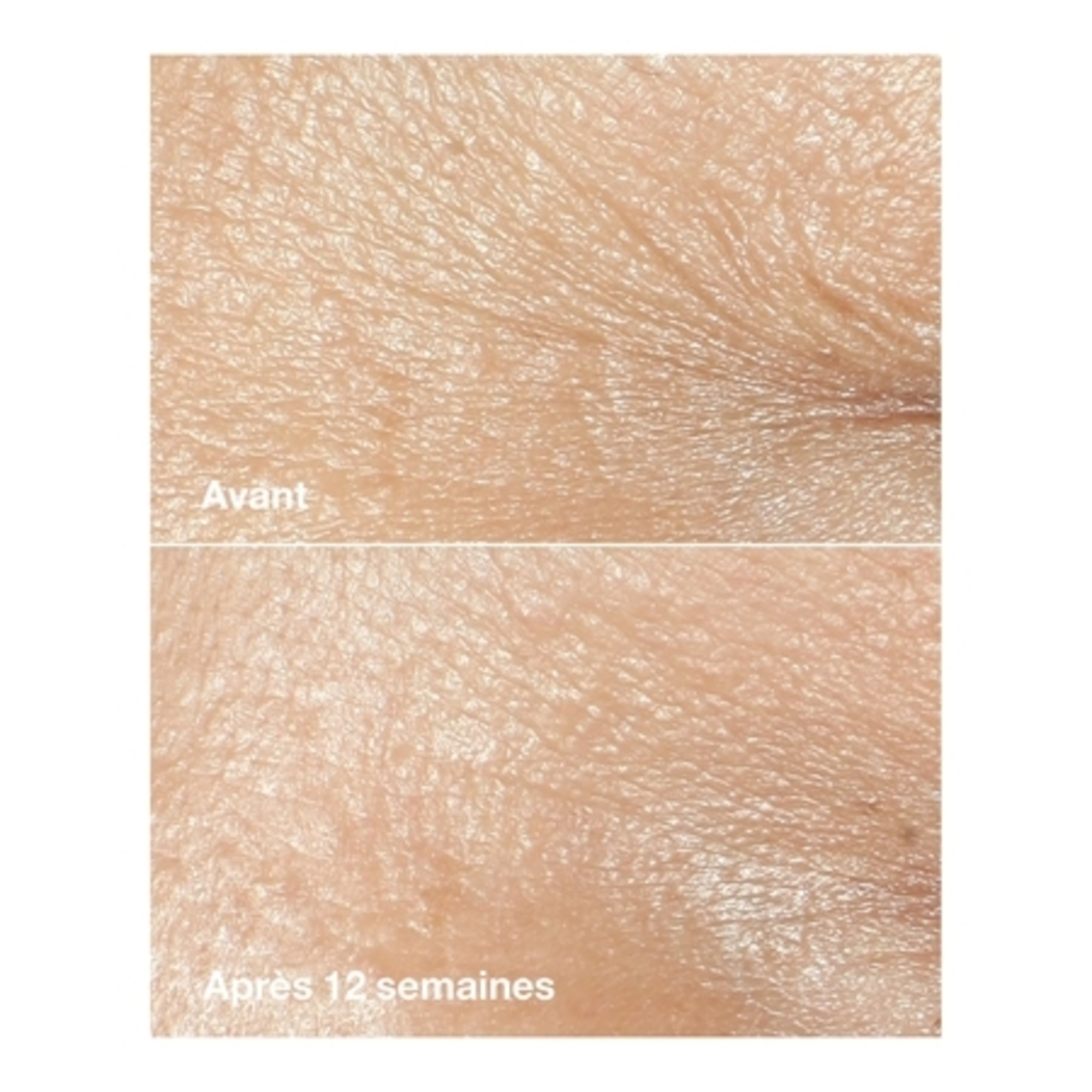 Smart clinical repair™ - crème riche correctrice anti-rides