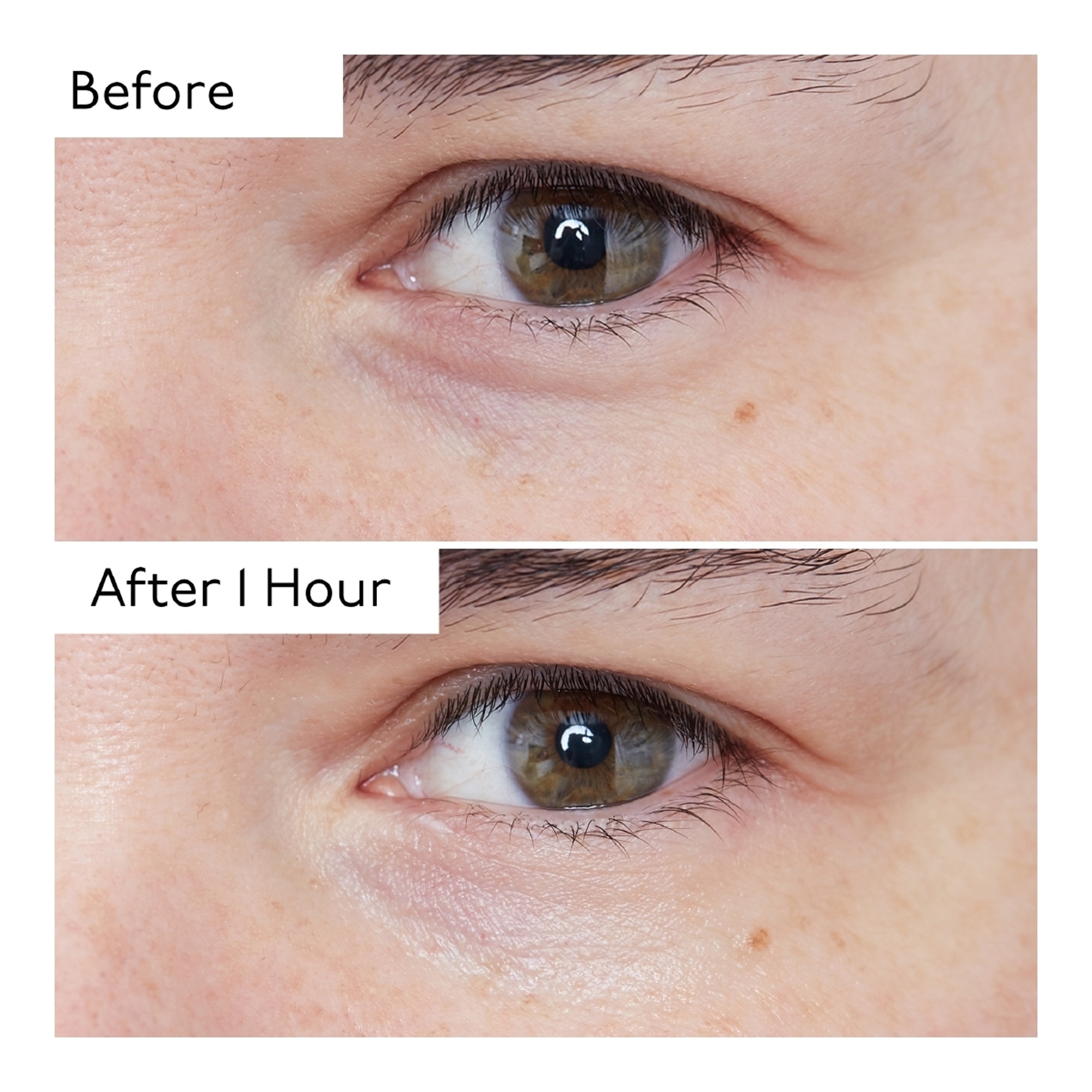 15ML BY TERRY HYALURONIC Sérum yeux  1 of 4 