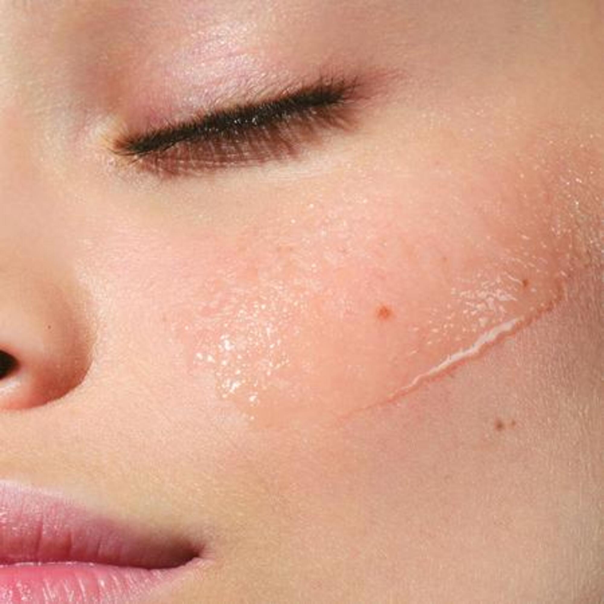 Purifiante – peau mixtes à grasses