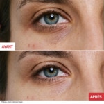 15mL ERBORIAN SKIN THERAPY EYE Crème yeux multi-perfectrice 3 of 4 Crème yeux multi-perfectrice